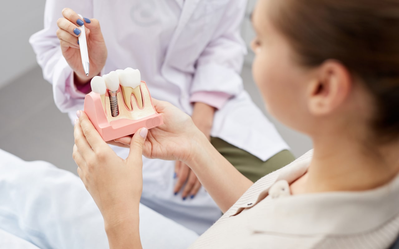 What Are Ottawa Dental Implants and Why Would I Need Them?
